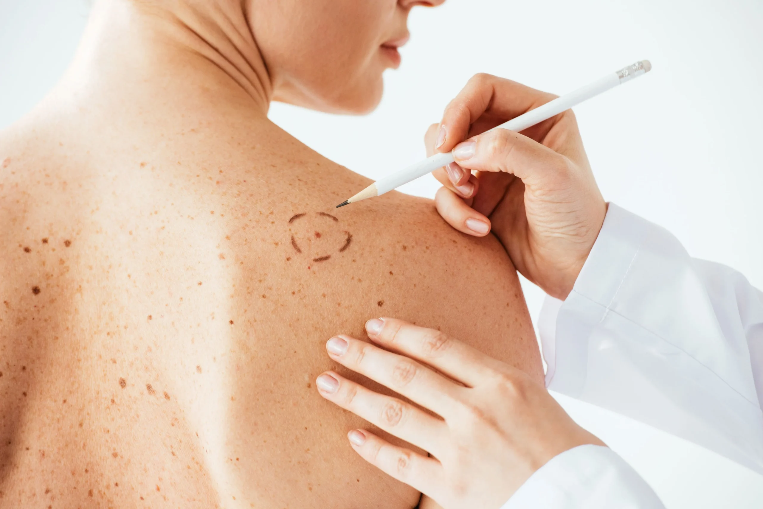 Dermatologia i dermatochirurgia 6 Derkomed