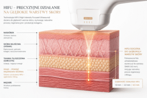 Terapia HiFu Tarnowskie Góry 