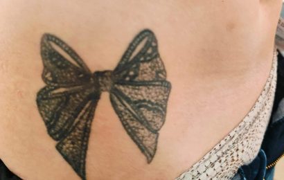 laserowe usuwanie tatuażu