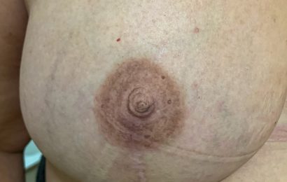 mikropigmentacja brodawki sutkowej